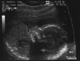 Babyface Profile