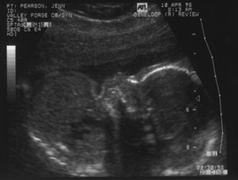 Babyface Profile