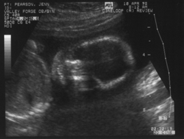 Baby's Portrait