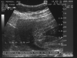 It's a Girl?!!